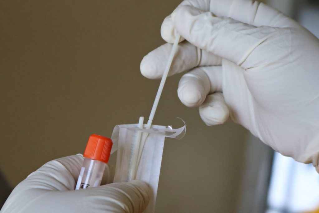 Informatie over het maken van een afspraak coronatest Amsterdam met snelle testresultaten